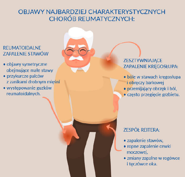 Rysunek informujący o objawach najbardziej charakterystycznych chorób reumatycznych: reumatoidalne zapalenie stawów, zesztywniające zapalenie kręgosłupa, zespół Reittera